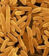 Image result for mikroba pengurai amonia