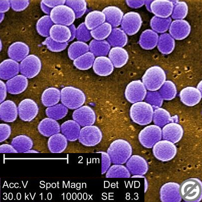 staphylococcus-aureus.jpg